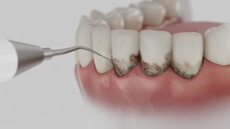 Trusted Teeth Cleaning And Checkup service in Kenova, WV - Dentist Open Now